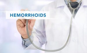 Hämorrhoiden Behandlung