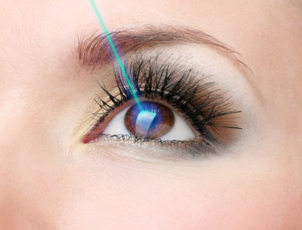 Augenlasern