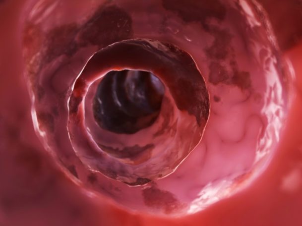Colon-Hydro-Therapie