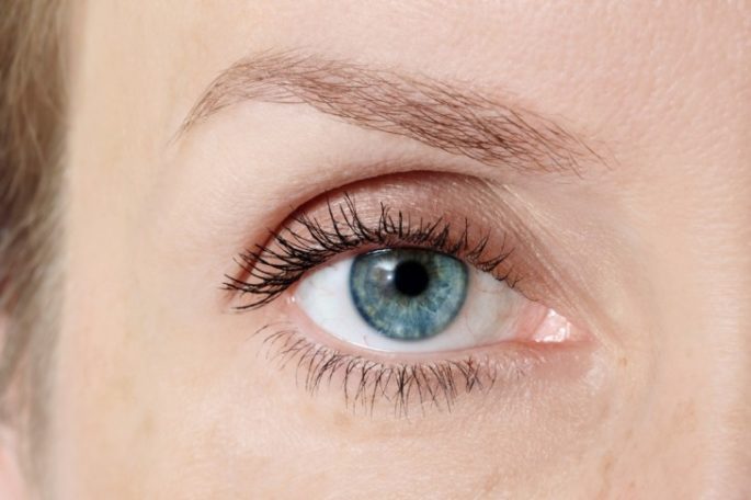 Lasik bei Kurzsichtigkeit