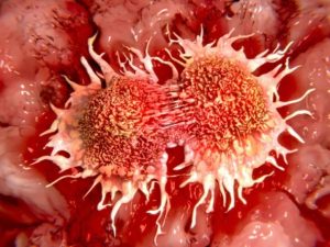Der Tumor-Terminator – Bakterium Clostridium novyi