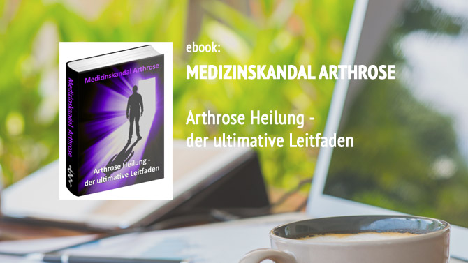 Buch über Arthrose