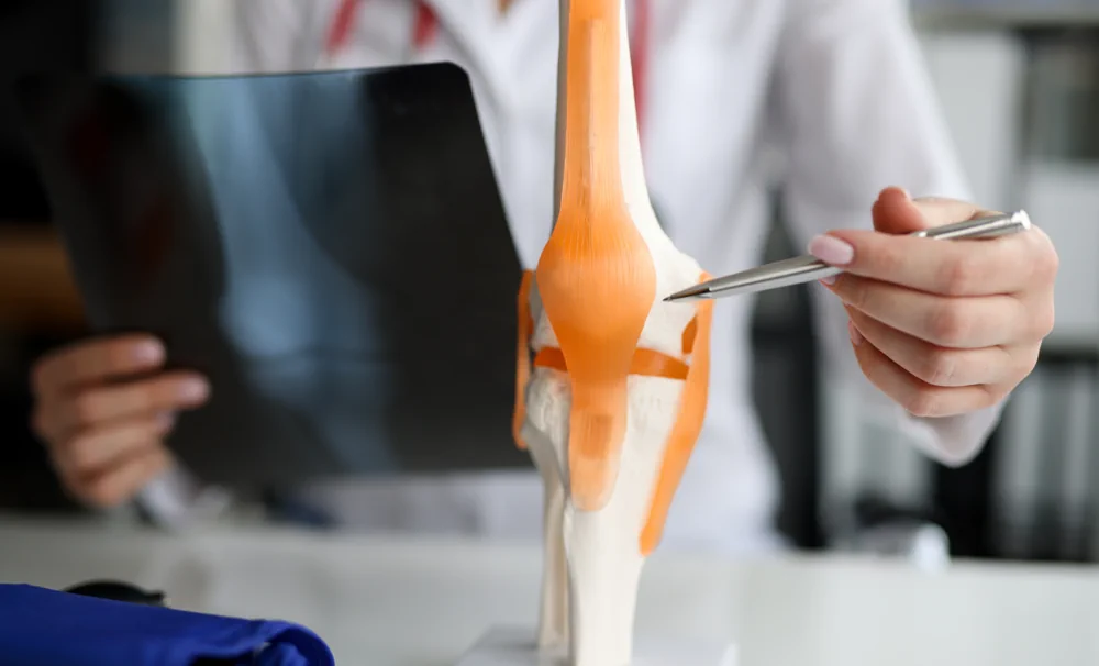 Arthrose